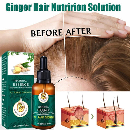 Ginger Infused Fast Growth Hair