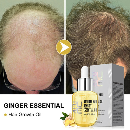 Ginger Hair Growth Serum