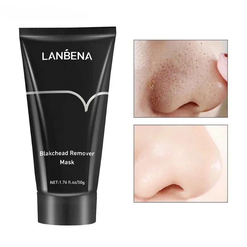 Blackhead Nose Patch | Blackhead Remover Patch | Pinkypiebeauty